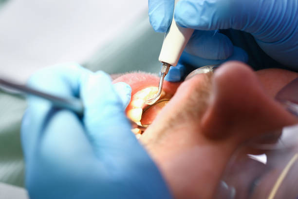 Best Pediatric Emergency Dentist in Wildwood, NJ
