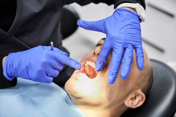 Best Emergency Dental Care for Broken or Chipped Teeth in Wildwood, NJ